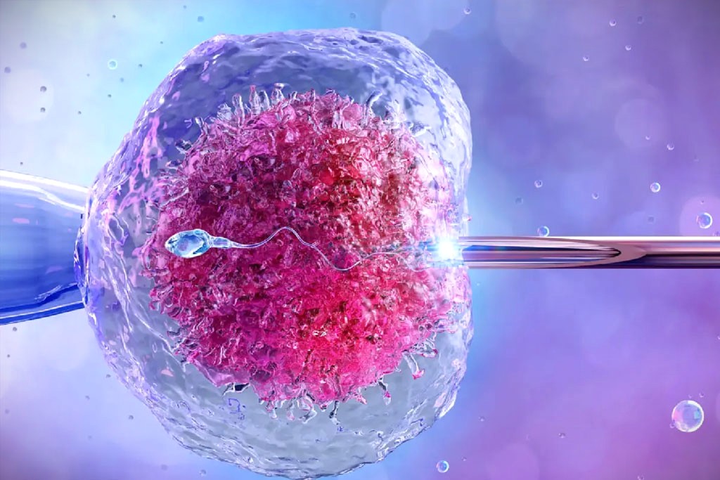 tekrarlayan implantasyon basarisizligi
